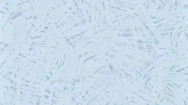 7015 Tropic Skyline - Mural Calypso